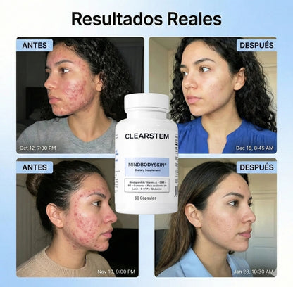 CLEARSTEM - MINDBODYSKIN Suplemento hormonal para el acné - OFERTA 2X1